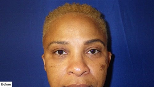 before Permanent Makeup